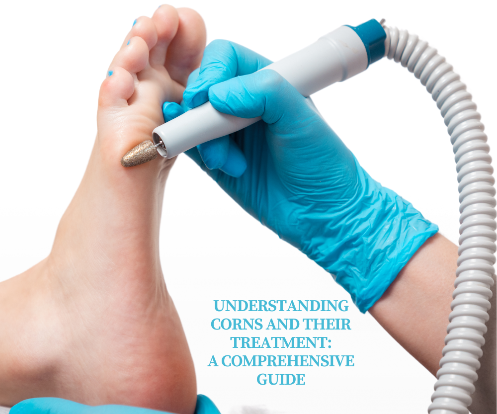 Understanding Corns and Their Treatment A Comprehensive Guide